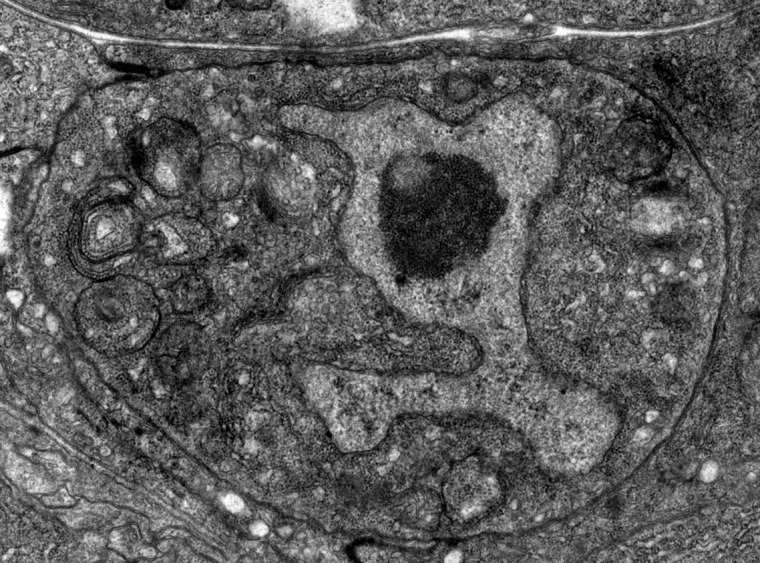 Linker cell death, a non-apoptotic death program in C. elegans.