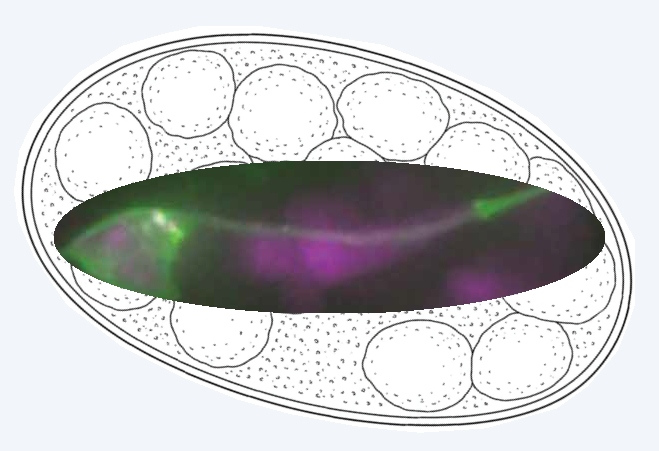 Timing of the decision to die in C. elegans development.